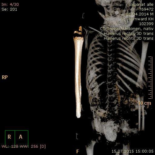 ギャラリー：特別展ミイラの展示品 古代エジプト、インカから日本まで