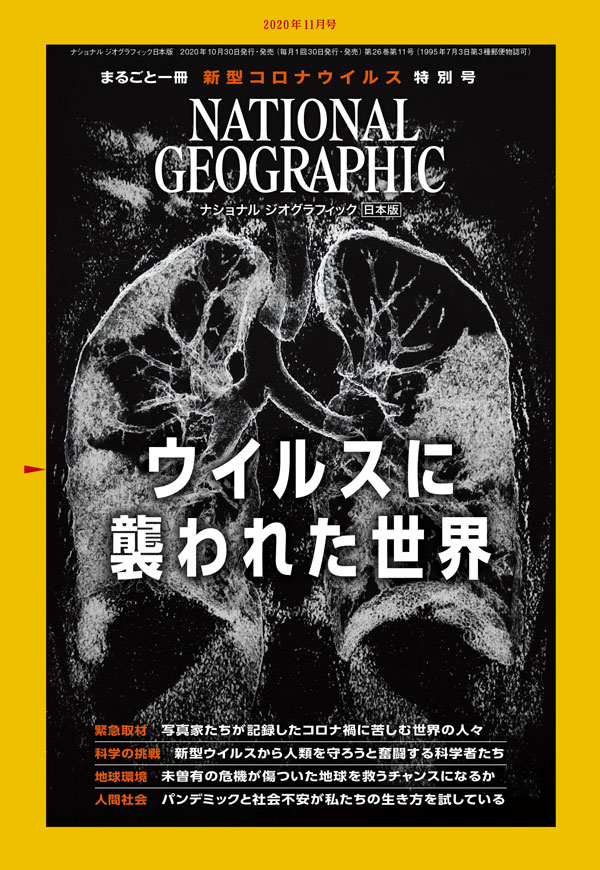 致死率30 超 スーパー耐性菌がコロナの陰で流行拡大の恐れ ナショナルジオグラフィック日本版サイト