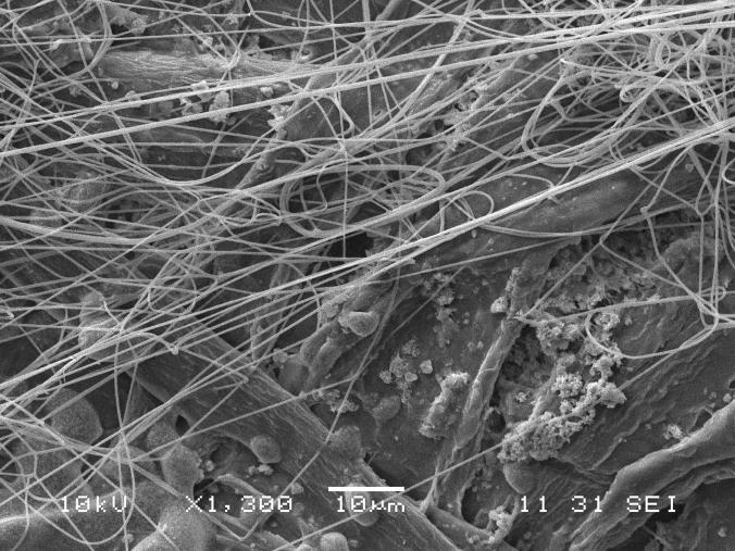 やる気のないオスを 口説く メスグモが見つかる ナショナルジオグラフィック日本版サイト