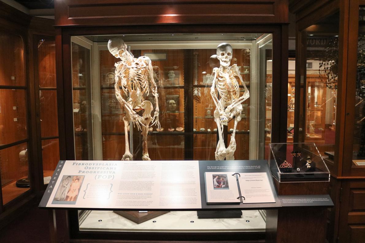 骨の難病と闘った女性 願い叶い博物館の展示に ナショナルジオグラフィック日本版サイト