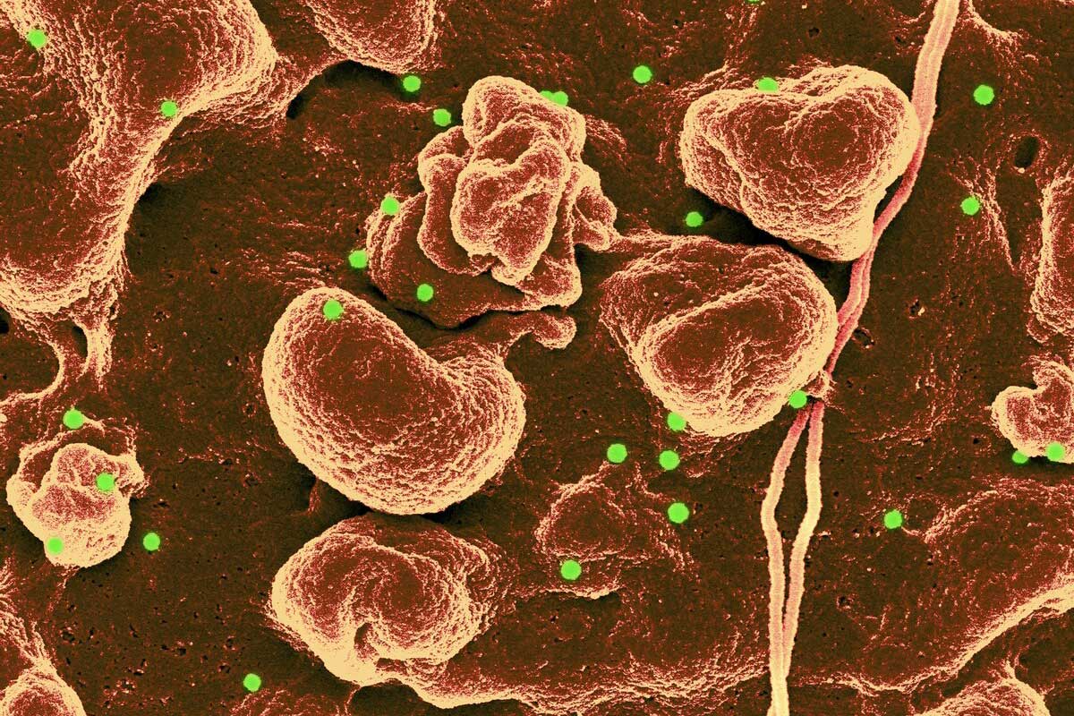 クリミア・コンゴ出血熱ウイルス（緑色）が、感染した上皮細胞の表面に現れる様子をとらえた走査電子顕微鏡の画像。（PHOTOGRAPH BY SCIENCE SOURCE）