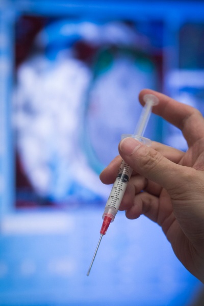 集束超音波治療の開始前、血流にはマイクロバブルが注入される。低強度の集束超音波がマイクロバブルを振動させ、これによって血液脳関門が一時的に開かれて、腫瘍に薬を届けられるようになる。(PHOTOGRAPH BY KEVIN VAN PAASSEN, SUNNYBROOK HEALTH SCIENCES CENTRE)