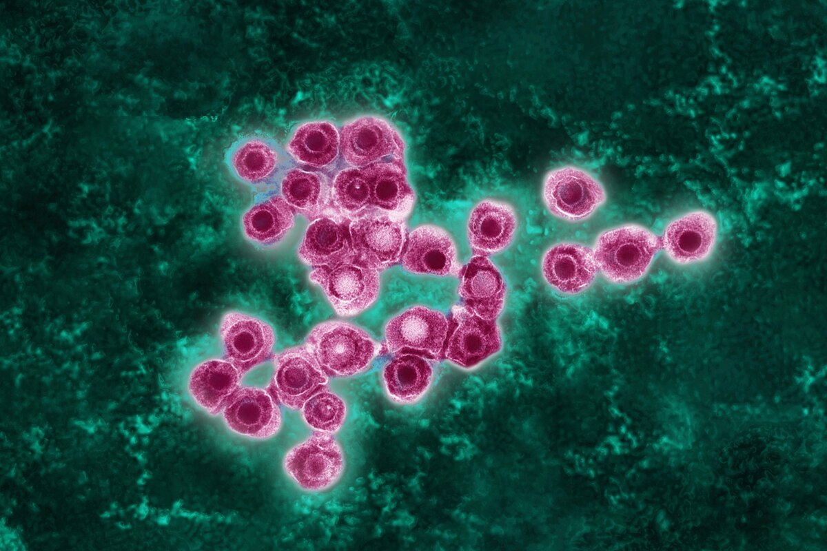 彩色した水痘・帯状疱疹ウイルスの透過型電子顕微鏡画像。（MICROGRAPH BY JAMES CAVALLINI, SCIENCE PHOTO LIBRARY）