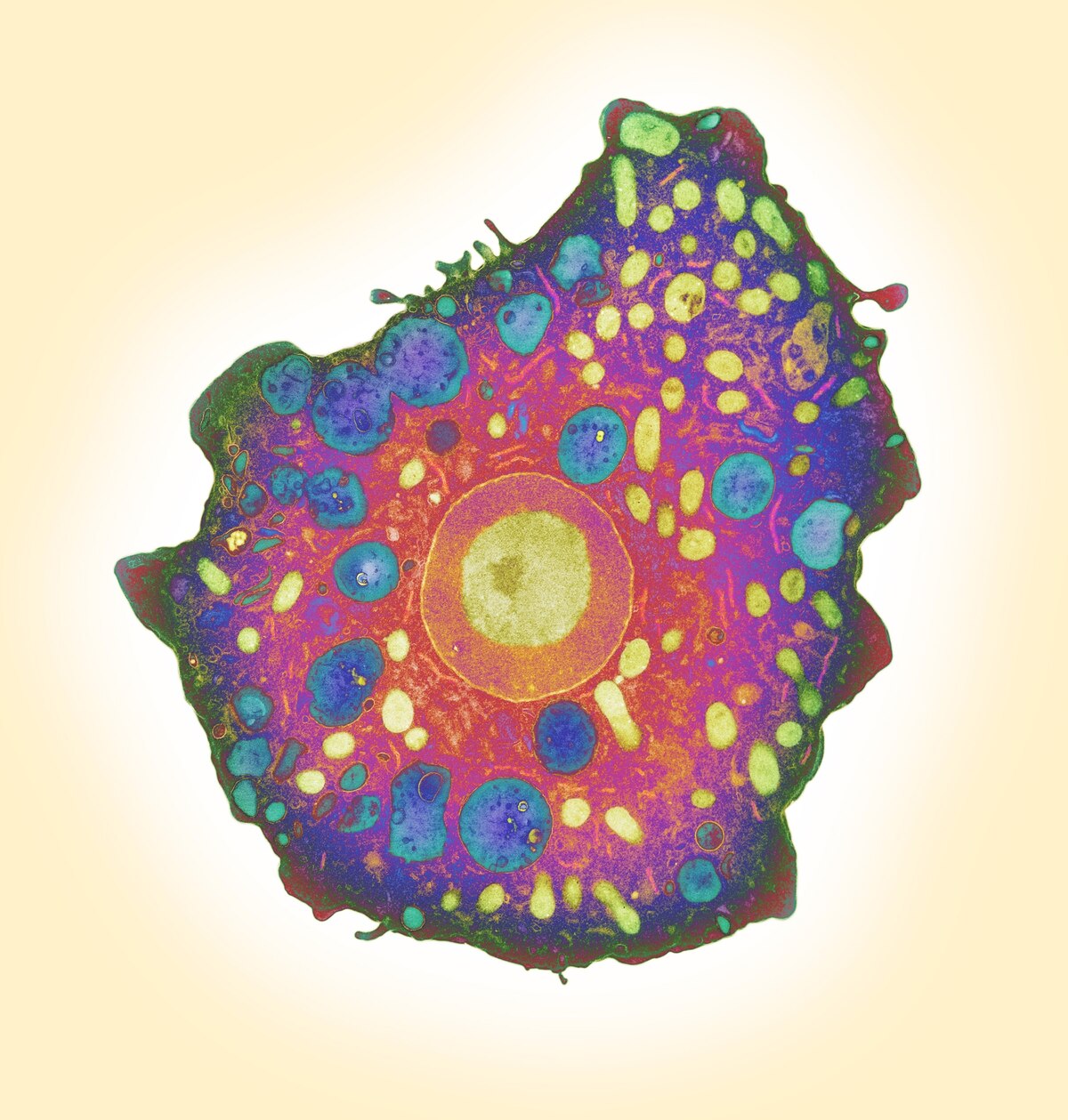 フォーラーネグレリア（Naegleria fowleri）というアメーバは、多くの場合、鼻に淡水が入ったときに人間に感染する。脳の炎症を引き起こして頭痛や嘔吐をもたらし、治療をしなければ、患者は昏睡状態から死に至る。（LONDON SCHOOL OF HYGIENE & TROPICAL MEDICINE, SCIENCE SOURCE）