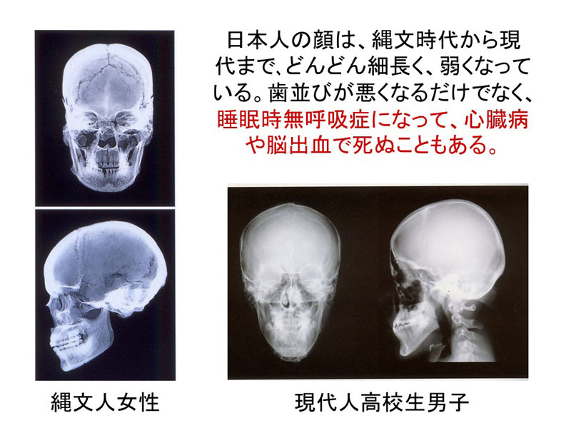 ギャラリー：「病気を生む顔」になる食べ物とは　画像5点（写真クリックでギャラリーページへ）