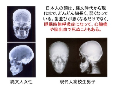ギャラリー:「病気を生む顔」になる食べ物とは 画像5点(写真クリックでギャラリーページへ)