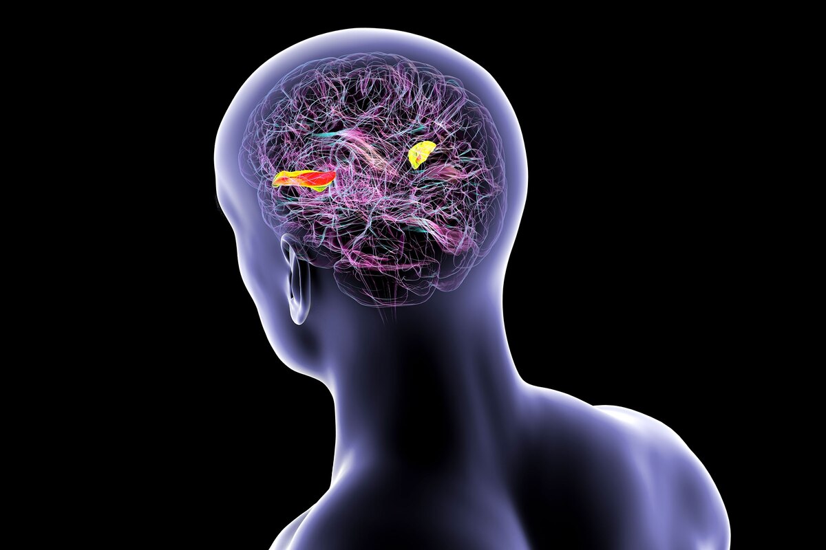 音の処理と言語理解を支える脳の横側頭回（おうそくとうかい＝前部は緑、後部はオレンジ）の図解。（KATERYNA KON, SCIENCE PHOTO LIBRARY）