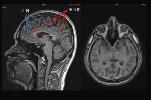 第2回 錯視から脳の新たな働きを解明ナショナルジオグラフィック日本版サイト
