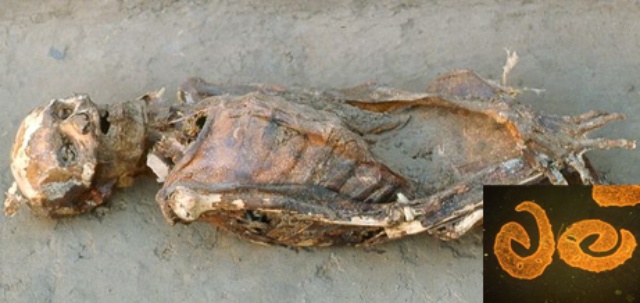 古代のミイラから住血吸虫を発見 ナショナルジオグラフィック日本版サイト 古代のミイラから住血吸虫を発見 ナショナルジオグラフィック日本版サイト